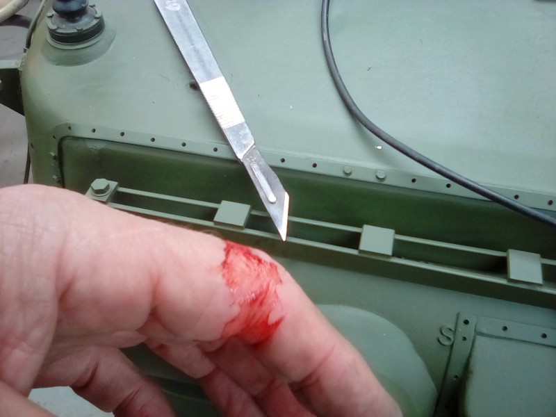 A new scalpel blade is the best way to cut yourself